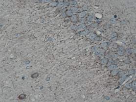 Anti-Cannabinoid Receptor I antibody(AB23703)