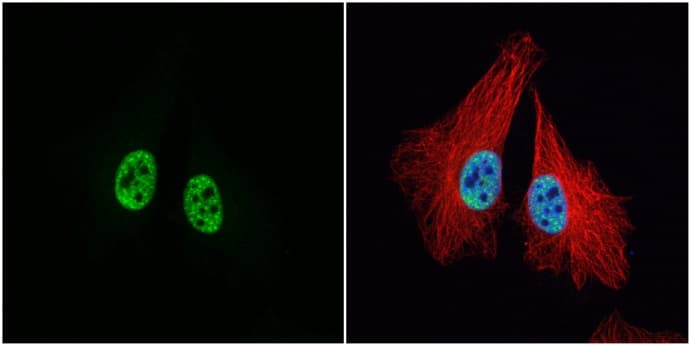 Anti-MCM3 antibody(AB272877)