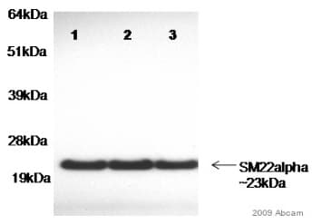 Anti-TAGLN/Transgelin antibody(AB14106)