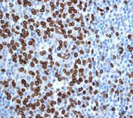Anti-Lamin A + Lamin C antibody [EPR4100] - Nuclear Envelope Marker(AB108595)