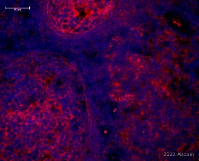 Anti-Glucose Transporter GLUT1 antibody [EPR3915] - BSA and Azide free(AB252403)