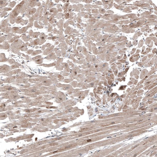 Anti-COL12A1 antibody(AB121304)