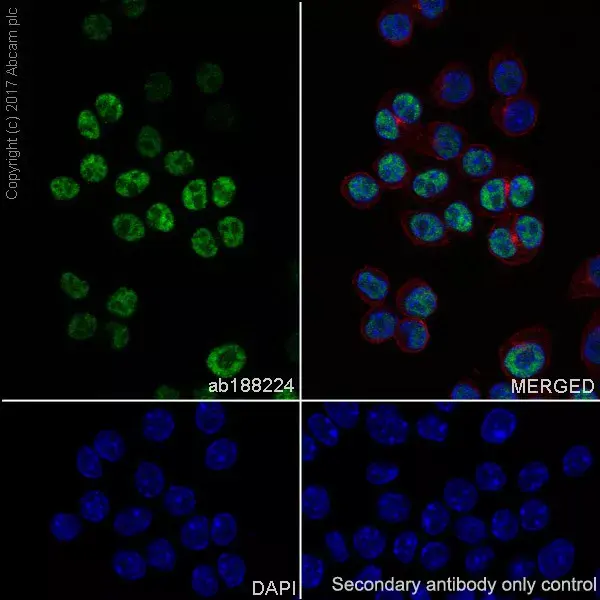 Anti-p21 antibody [EPR18021](AB188224)