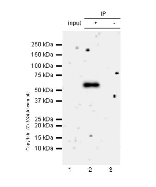Anti-ST2 antibody [EPR28307-82](AB317557)