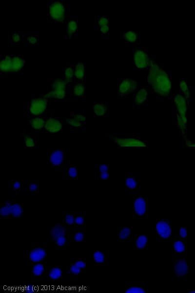 Anti-Islet 1 antibody [EP4182] - Neural Stem Cell Marker(AB109517)