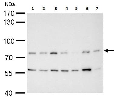 Mdm2 Antibody Chip Grade Ab226939  Western Blot Img121842