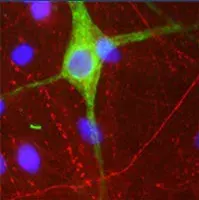Anti-Peripherin antibody(AB39374)