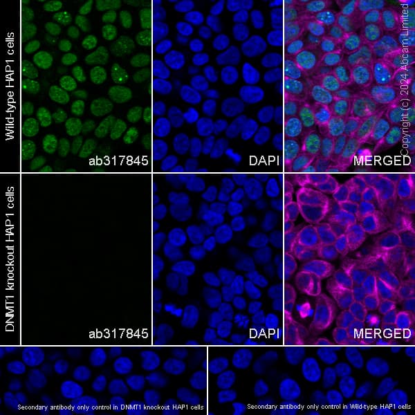 Dnmt1 Antibody Rm1192 Ab317845  Immunocytochemistry Immunofluorescence Img434436