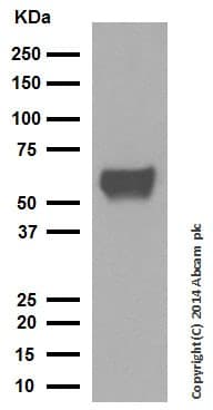 Anti-Cytokeratin 10 antibody [EP1607IHCY] - Cytoskeleton Marker(AB76318)