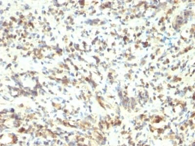 Anti-MyoD1 antibody [5.8A](AB233941)