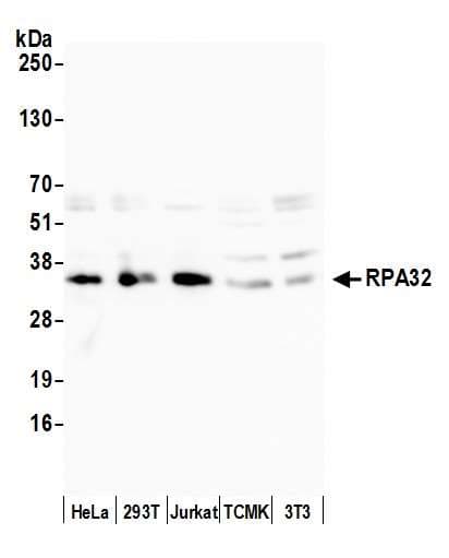 Anti-RPA32/RPA2 antibody(AB10359)
