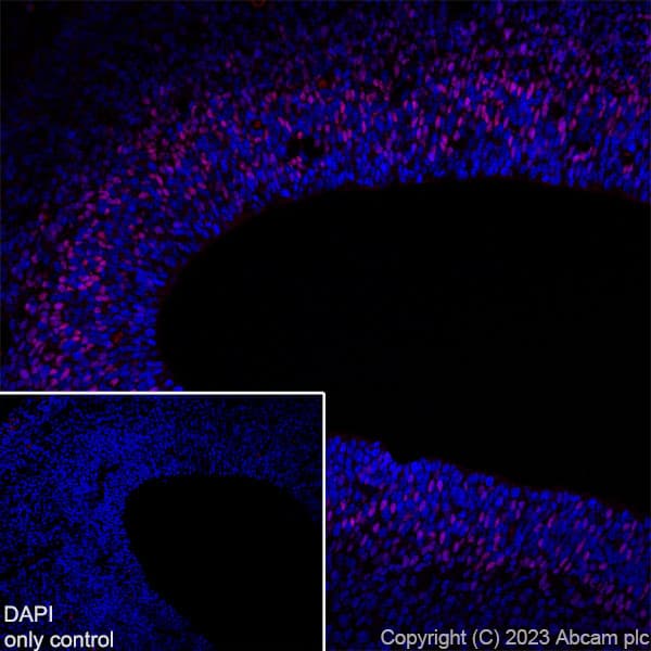 Alexa Fluor® 647 Anti-TBR2 / Eomes antibody [EPR19012](AB315356)