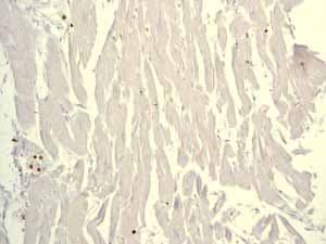 Anti-Lysozyme antibody [EPR2994(2)](AB108508)