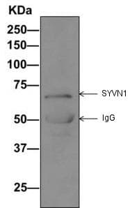Syvn1 Hrd1 Antibody Ep7459 Bsa And Azide Free Ab249578  Immunoprecipitation Img76753