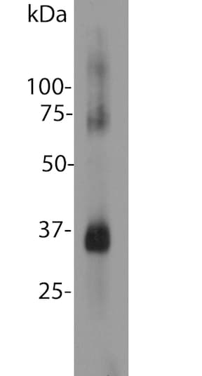 Anti-Rhodopsin antibody [A531](AB190307)