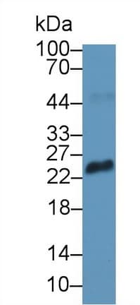 Anti-RS1 antibody(ab233428)
