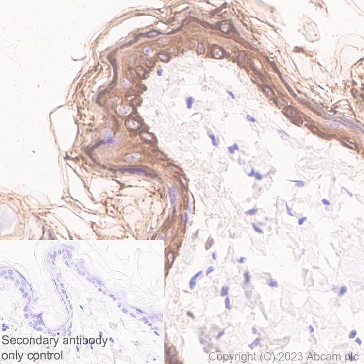 Pan Cytokeratin Antibody Epr28285 45 Bsa And Azide Free Ab308263  Immunohistochemistry Formalin Pfa Fixed Paraffin Embedded Sections Img408895