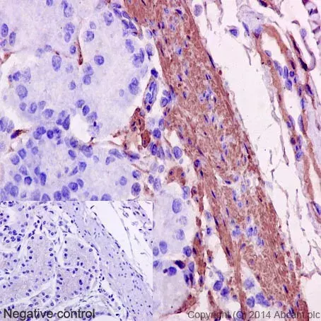 Anti-alpha smooth muscle Actin antibody [EPR5368](AB124964)