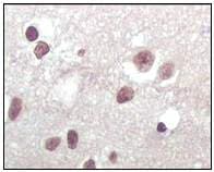 Anti-CDKN2A/p16INK4a antibody [2D9A12](AB54210)