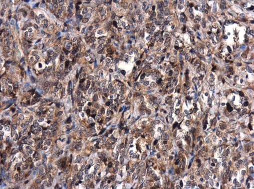 Mdm2 Antibody Chip Grade Ab226939  Immunohistochemistry Formalin Pfa Fixed Paraffin Embedded Sections Img116980