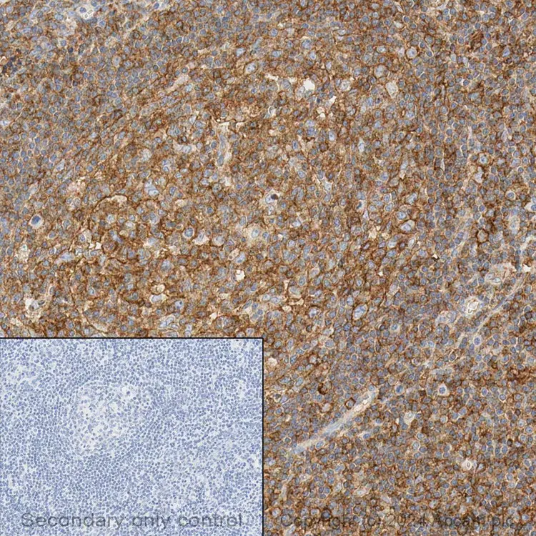 Anti-HLA A antibody [EP1395Y](AB52922)