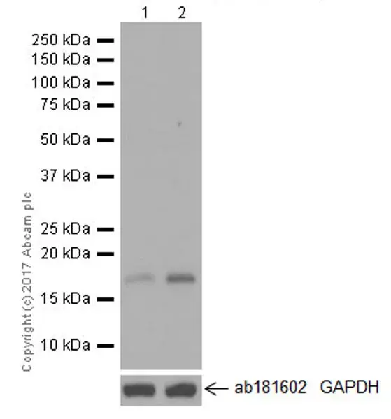 Anti-p21 antibody [EPR18021](AB188224)