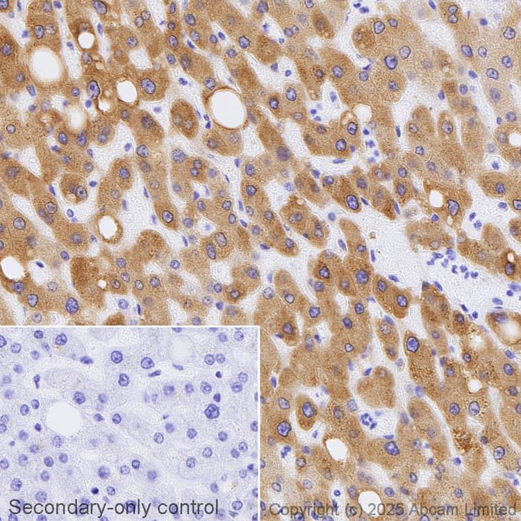 Avidin/Biotin Blocking Kit(ab64212)