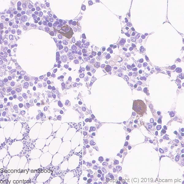 Thrombospondin 1 Antibody Epr22928 10 Bsa And Azide Free Ab263952  Immunohistochemistry Formalin Pfa Fixed Paraffin Embedded Sections Img97510