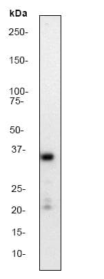 Anti-Synaptophysin antibody [YE269](ab32127)