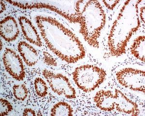 Anti-BANF1/BAF antibody [EPR7668](AB129184)