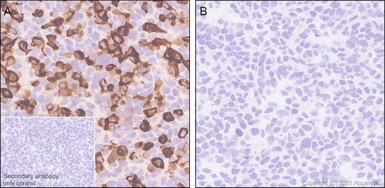 Anti-Rfx Cas13d (N-term) antibody [EPR23965-31](AB314741)