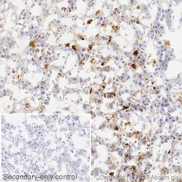 Anti-Cathepsin D antibody [EPR3057Y](ab75852)