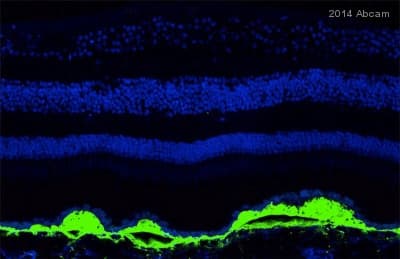 Anti-C5b-9 + C5b-8 antibody [aE11](AB66768)