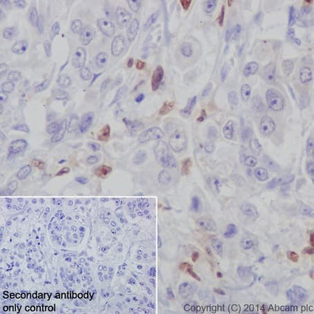 Anti-IRF5 antibody [EPR17067](AB181553)