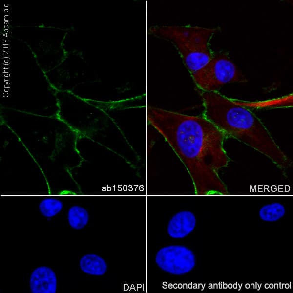 Anti-LRRC15 antibody [EPR8188(2)](AB150376)