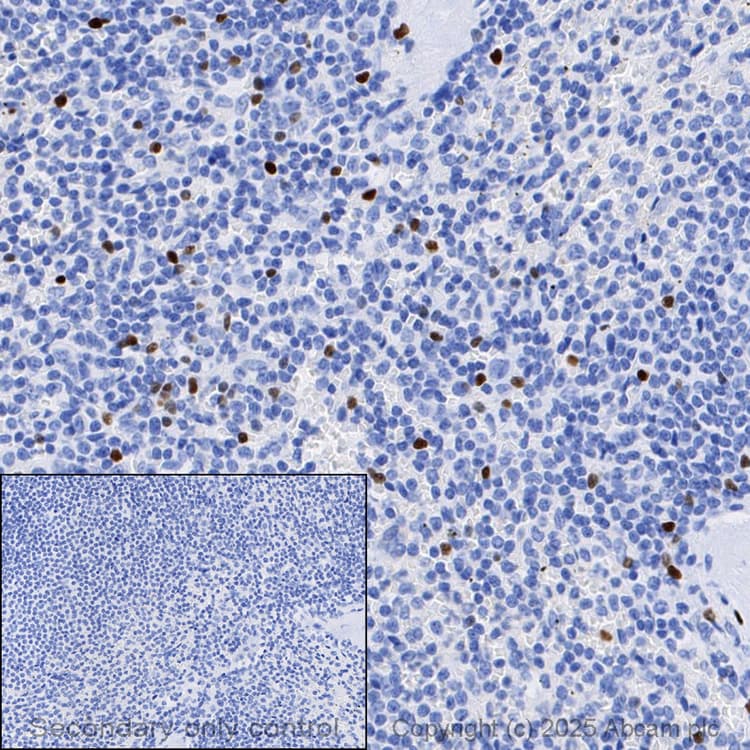 Anti-FOXP3 antibody [SP97](AB99963)