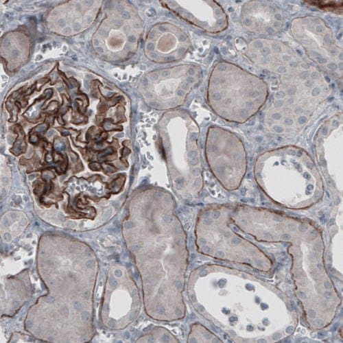 Anti-Laminin alpha 5/LAMA5 antibody [CL3118](AB210957)