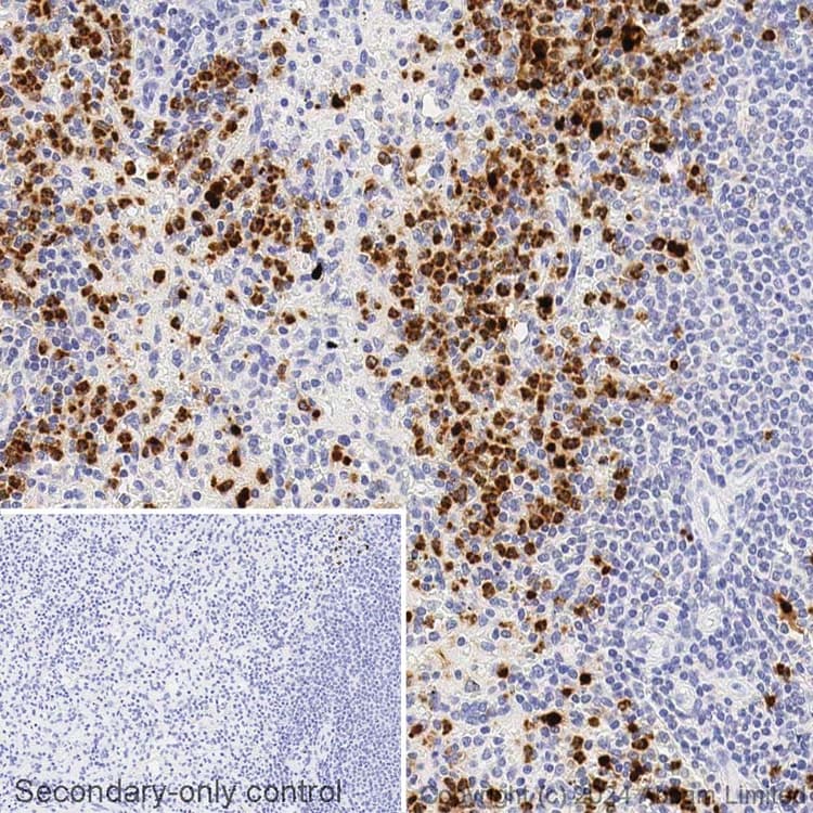 Avidin/Biotin Blocking Kit(ab64212)