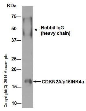 Anti-CDKN2A/p16INK4a antibody [EPR1473] - BSA and Azide free(AB186932)