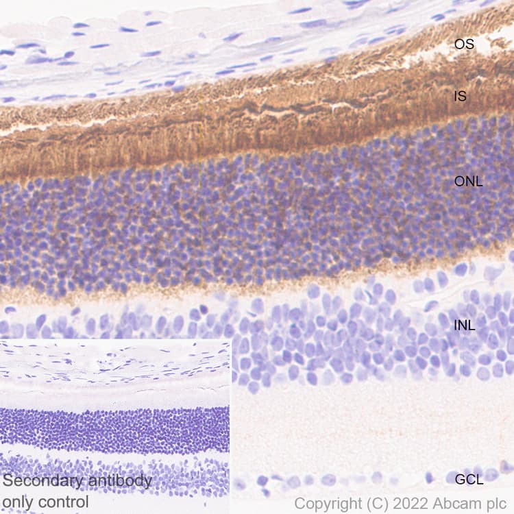 Anti-ABCA4 antibody [EPR26543-66](AB303504)