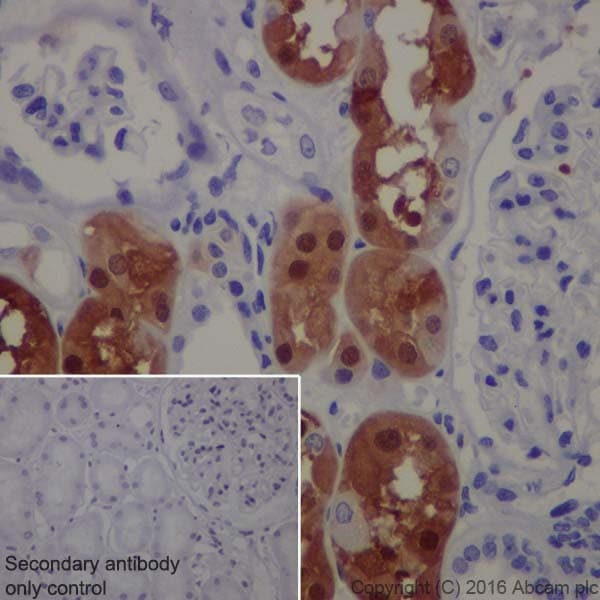S100 Alpha Antibody Epr19013 Ab183979  Immunohistochemistry Formalin Pfa Fixed Paraffin Embedded Sections Img11005
