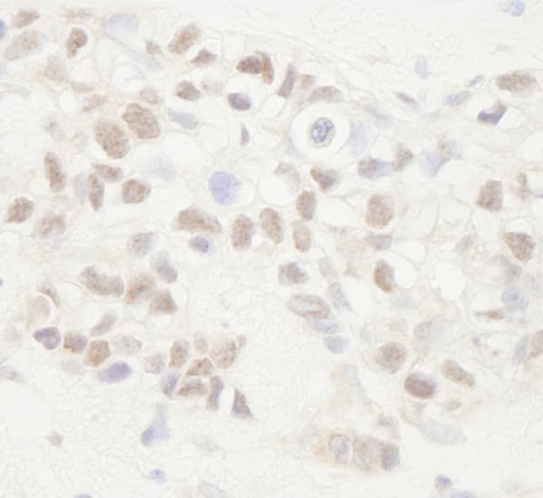 Apc Antibody Ab72040  Immunohistochemistry Formalin Pfa Fixed Paraffin Embedded Sections Img131507
