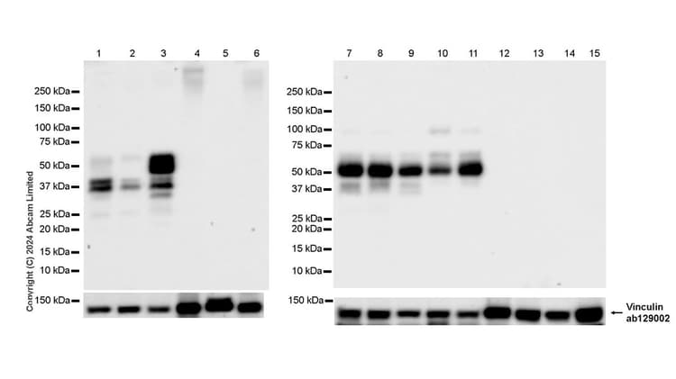 Anti-Tau (MTBR-tau243) antibody [EPR29541-59](AB322554)