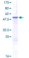 Recombinant Human PGRMC1 protein(AB132523)
