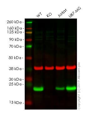 Anti-Cyclophilin B antibody(AB16045)
