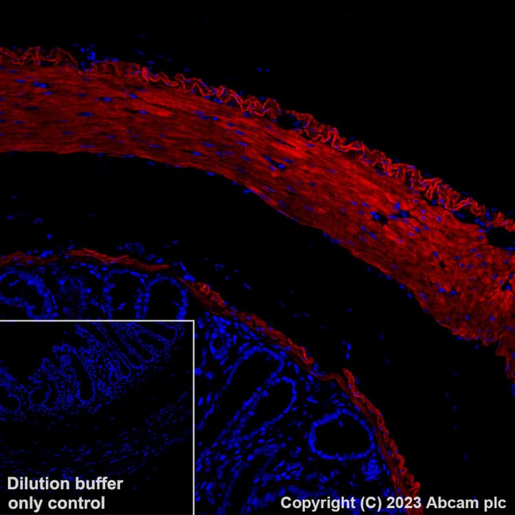 Alexa Fluor® 647 Anti-Fibronectin antibody [EPR23110-46](AB313350)