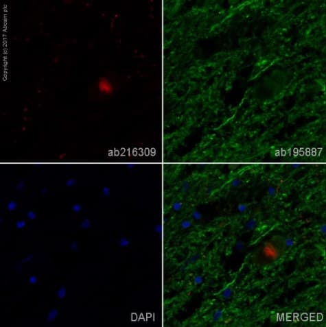 Anti-Alpha-synuclein aggregate antibody [MJFR-14-6-4-2] - Conformation-Specific(AB209538)