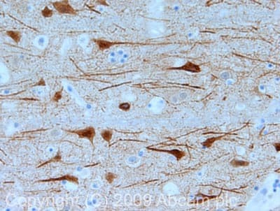 Anti-MAP2 antibody - Neuronal Marker(AB32454)