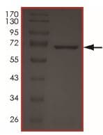 Recombinant human MYLK4 protein(AB190995)