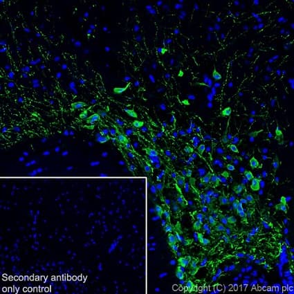 Anti-Vasopressin antibody [EPR20602](AB213708)